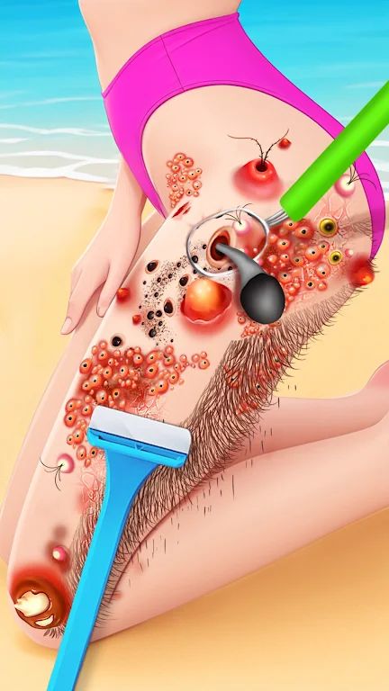 寻找匹配 寻找匹配