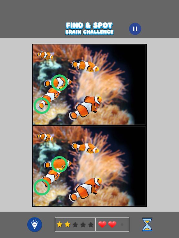 发现差异:大脑挑战 发现差异:大脑挑战